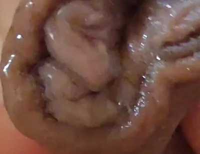 Large Foreskin and Balls in Striking Close-up.