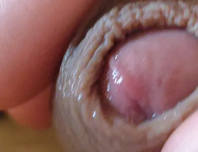 Large Foreskin and Balls in Striking Close-up.