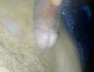 Boy Roasts His Straw and Smears It All Over His Stomach at Night While His Parents Are Away