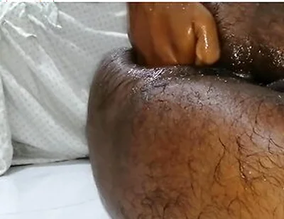 තම පකට තම අතමය පටටම ෆසටන එකක කර වදනව Extreme Self Fisting Best One Ever Huge Cum Load