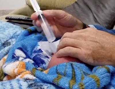 60cc Saline Injection in Each Egg