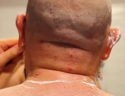 Shave Bald Head and Worship