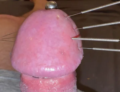 Needles Through the Thick, Hard Glans, Mega Orgasm