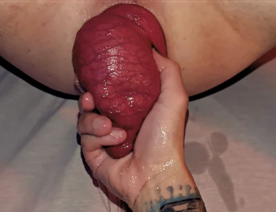 Arty Boer and Prolapsiboy.