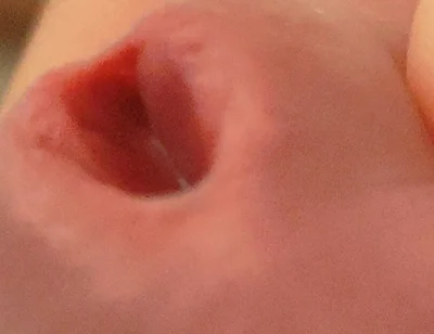 Amazing Closeup of the Widened Hole!!