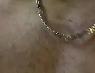 Two Twinkies, Secluded in the Forest