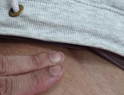 The Hair on My Penis - Led Hair Removal