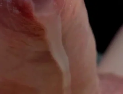 Phimosis Cock Leaking Cum Close-up Hands-free