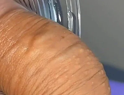 Mysterious Solution Inserted Into the Wrinkled Cock.