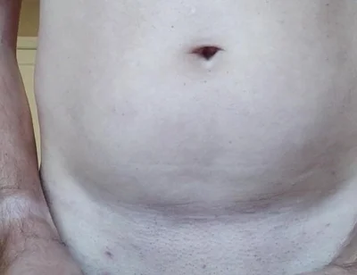 Dilatator