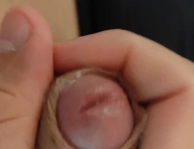 Amazing Pre Cum Glans.