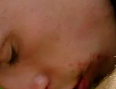 Bonus: Davey Receives 1,000 Kisses