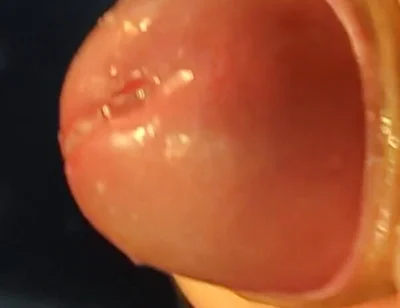 Juicy Close up