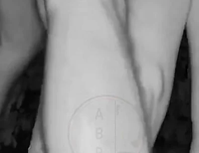 In a Park, at Night, Jules Is Desperate to Pee and Tries to Hide From His Friend but Is Caught on Night Vision Cam