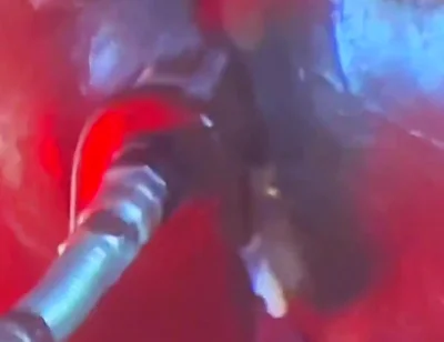 Intense Verbal Play Ahead...