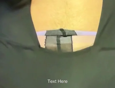 Crossdresser Cdmichelle Wearing Doted Pantyhoes Black Bodysuit