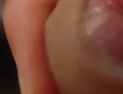 Great Phimosis Getting in the Way of the Boy's Orgasm