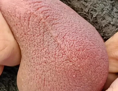 Big Uncut Cock Edging and Cumming, Outdoor Onesie Wank for the Neighbours - Rockardglans