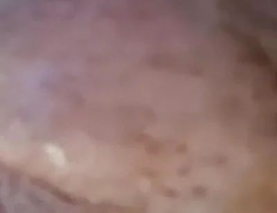 Extreme Fillings Inside My Siliconemeat