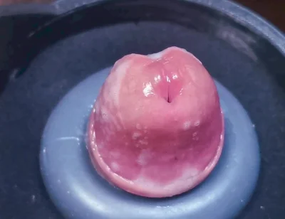 Penis Machine with a New Attachment