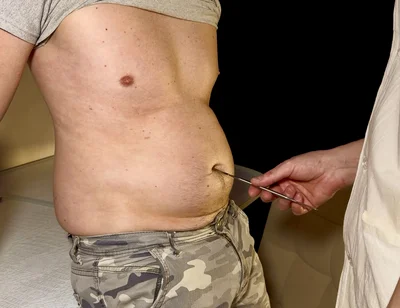 Swollen Perfection - Private Check-up