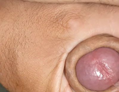 Enjoy the Uncircumcised Welcome Gift.