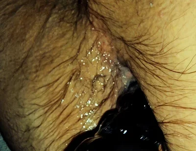 Training My Sloppy Hole