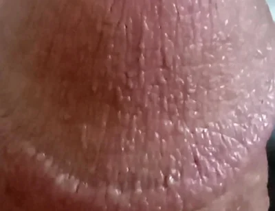 My Dick