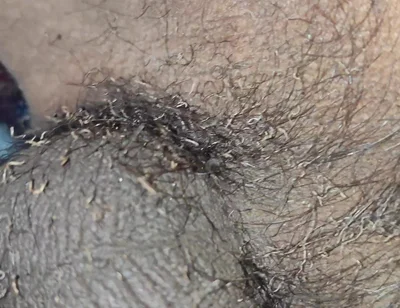 My Bushes Catch Fire Burning Penis Shaved Penis by Fire