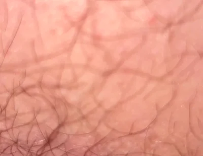 Close up Hairy Hole