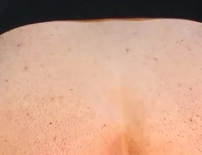 He Enjoys Sucking on His Anal Prolapse