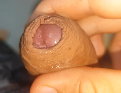 Its Source of Protein Is Already Dawning Like Rock