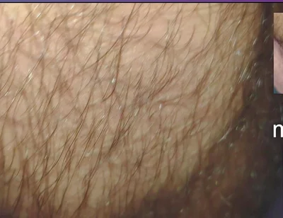 The Texture of the Clothes