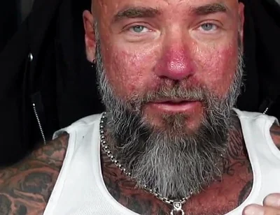 How to Stop Sexual Performance Anxiety