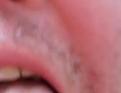 Camera Blunder in the Attempt at Facial Insemination