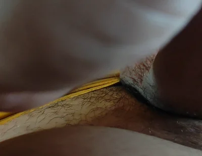 Application of Instant Phimosis Remover