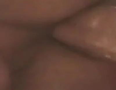 Gaping Anal Prolapse Overflow - Rosebud Pulsing Wide Open