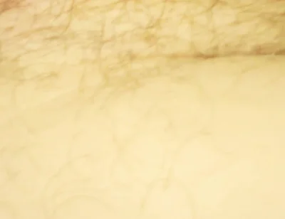 Close up of My Hole