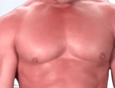 Be My Dental Patient and Pretend to Be Kyle