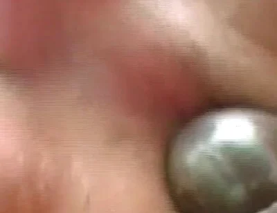 Gaping Anal Rosebud Prolapsing After Deep Stretching Session