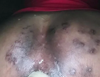 Up and Personal with the Thrashy Ass of a CD