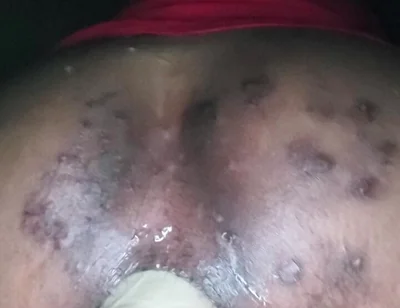 Up and Personal with the Thrashy Ass of a CD