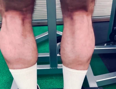 My Legs