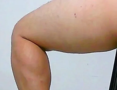 Oh, My Ass Hurts, Apply Ointment