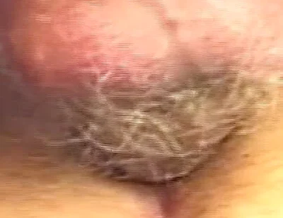 Outdoor Anal Stretching with Dripping Cocks and Gaping Holes