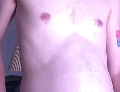 Young Mans Belly Turns Into a Orb