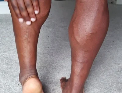 For My Feet Lovers