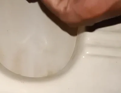 Urinating From the Penis