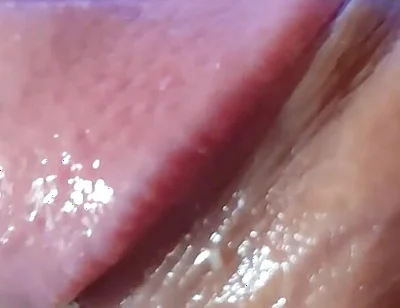 Strange Lumpy Cock with a Gigantic Head.