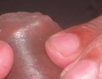 Forskin Play & My Thick Veiny Cock Shooting a Massive Creamy Load